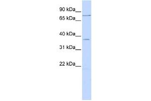WB Suggested Anti-ZNF264 Antibody Titration:  0. (ZNF264 抗体  (N-Term))