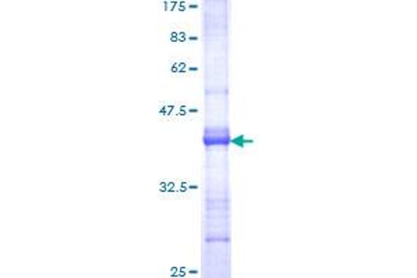 DMBT1 Protein (AA 1377-1485) (GST tag)