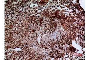 Immunohistochemistry (IHC) analysis of paraffin-embedded Human Lung, antibody was diluted at 1:100. (LAMC2 抗体  (C-Term))