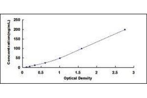 ELISA image for IgM ELISA Kit (ABIN415634)