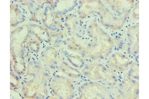 Immunohistochemical of paraffin-embedded human kidney tissue using ABIN7176818 at dilution of 1:200. (PLA2G7 抗体)