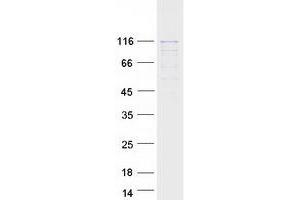 Western Blotting (WB) image for Heat Shock 70kDa Protein 4 (HSPA4) protein (Myc-DYKDDDDK Tag) (ABIN2723100)