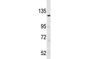 Western Blotting (WB) image for anti-LATS, Large Tumor Suppressor, Homolog 1 (Drosophila) (LATS1) (AA 1-30) antibody (ABIN3031593)