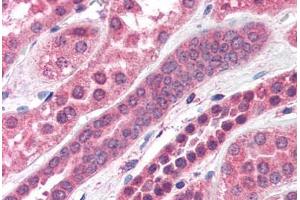 Human Kidney (formalin-fixed, paraffin-embedded) stained with STXBP6 antibody ABIN351472 at 3. (STXBP6 抗体  (AA 2-14))