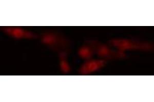 ABIN6274560 staining HeLa cells by IF/ICC. (Spindlin 1 抗体  (N-Term))