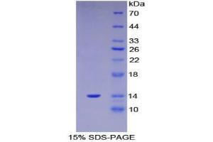 SDS-PAGE analysis of Human S100A11 Protein. (S100A11 蛋白)