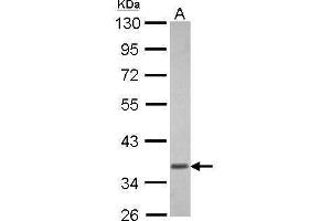 anti-Guanine Nucleotide Binding Protein (G Protein), alpha Transducing Activity Polypeptide 1 (GNAT1) (Center) antibody