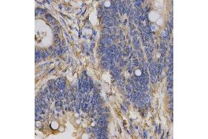 Immunohistochemistry (IHC) image for anti-Chloride Channel 5 (CLCN5) antibody (ABIN1876908) (Chloride Channel 5 抗体)