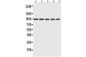 Western Blotting (WB) image for anti-Progesterone Receptor (PGR) (AA 595-933) antibody (ABIN3042523) (Progesterone Receptor 抗体  (AA 595-933))