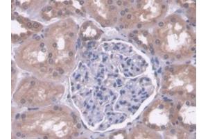 DAB staining on IHC-P; Samples: Human Kidney Tissue (PC 抗体  (AA 36-486))