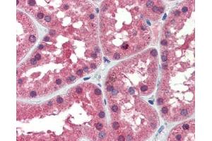 IDH1 antibody was used for immunohistochemistry at a concentration of 4-8 ug/ml. (IDH1 抗体)