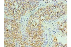 Immunohistochemistry of paraffin-embedded human tonsil tissue using ABIN7171432 at dilution of 1:100 (CCT6A 抗体  (AA 80-250))
