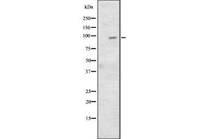 Western blot analysis of CD97 expression in HepG2 whole cell lysate; HCT116 whole cell lysate;,The lane on the left is treated with the antigen-specific peptide. (CD97 抗体  (Internal Region))