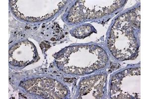 Immunohistochemistry (IHC) image for anti-Glutathione S-Transferase mu 3 (Brain) (GSTM3) antibody (ABIN5708464)