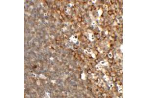 Immunohistochemistry of TFCP2L1 in rat colon tissue with TFCP2L1 antibody at 2. (TFCP2L1 抗体  (N-Term))