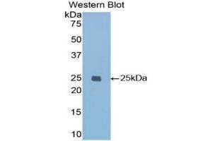Western Blotting (WB) image for anti-Insulin-Like Growth Factor Binding Protein 7 (IGFBP7) (AA 88-281) antibody (ABIN1859314) (IGFBP7 抗体  (AA 88-281))