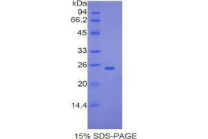 SDS-PAGE analysis of Mouse UCHL5 Protein. (UCHL5 Protein (C-Term))