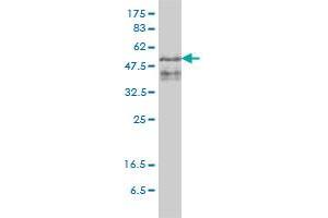 ZFYVE19 monoclonal antibody (M01), clone 4D5-2D11 Western Blot analysis of ZFYVE19 expression in PLC/PRF/5 . (ZFYVE19 抗体  (AA 1-396))