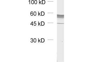 dilution: 1 : 1000, sample: unboiled synaptic membrane fraction of rat brain (LP1) (GABRB1 抗体  (AA 342-430))
