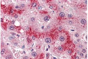 Human Liver (formalin-fixed, paraffin-embedded) stained with LEPR antibody ABIN364407 at 4 ug/ml followed by biotinylated anti-goat IgG secondary antibody ABIN481715, alkaline phosphatase-streptavidin and chromogen. (Leptin Receptor 抗体  (AA 829-841))