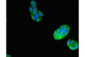 Immunofluorescent analysis of PC-3 cells using ABIN7175304 at dilution of 1:100 and Alexa Fluor 488-congugated AffiniPure Goat Anti-Rabbit IgG(H+L) (VPS29 抗体  (AA 68-145))