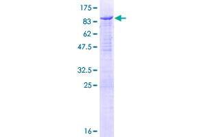 Neural Wiskott-Aldrich syndrome protein (WASL) (AA 1-505) protein (GST tag)