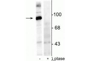 Western blot of rat hippocampal lysate stimulated with forskolin showing specific immunolabeling of the ~95 kDa dynamin phosphorylated at Ser774 in the first lane (-). (Dynamin 1 抗体  (pSer774))