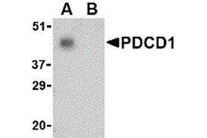 Western Blotting (WB) image for anti-Programmed Cell Death 1 (PDCD1) (C-Term) antibody (ABIN2479657) (PD-1 抗体  (C-Term))