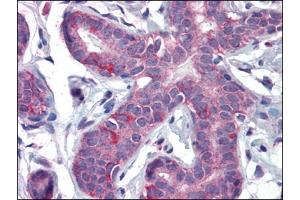 Immunohistochemistry Image: Human Breast: Formalin-Fixed, Paraffin-Embedded (FFPE) (PPARD 抗体  (C-Term))