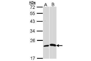 WB Image Sample (30 ug of whole cell lysate) A: H1299 B: Molt-4 , 12% SDS PAGE antibody diluted at 1:1000 (CRP 抗体)
