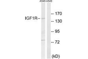 Western blot analysis of extracts from A549 cells, using IGF1R (Ab-1346) Antibody. (IGF1R 抗体  (AA 1311-1360))