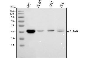 Western blot analysis of HLA A using anti-HLA A antibody (ABIN3043842).