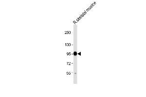 Anti-CO Antibody (Center) at 1:2000 dilution + Rat skeletal muslce lysate Lysates/proteins at 20 μg per lane. (COMP 抗体  (AA 314-343))
