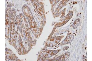IHC-P Image Immunohistochemical analysis of paraffin-embedded human colon, using PKA alpha, antibody at 1:100 dilution. (PRKACA 抗体  (Center))