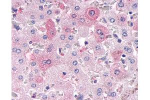 Anti-MKP-8 / DUSP26 antibody IHC of human liver. (DUSP26 抗体  (Internal Region))