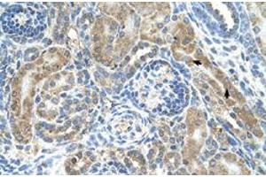 Immunohistochemical staining (Formalin-fixed paraffin-embedded sections) of human kidney with CRELD1 polyclonal antibody  at 4-8 ug/mL working concentration. (CRELD1 抗体  (C-Term))