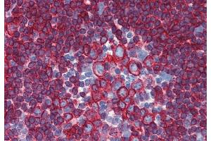 Immunohistochemistry staining of human small intestine (paraffin-embedded sections) with anti-HLA-DR+DP (HL-40). (HLA-DP/DR 抗体)