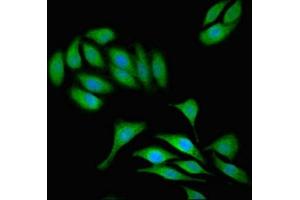 Immunofluorescent analysis of A549 cells using ABIN7171966 at dilution of 1:100 and Alexa Fluor 488-congugated AffiniPure Goat Anti-Rabbit IgG(H+L) (TAB3 抗体  (AA 361-712))