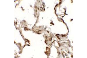 Immunohistochemistry of TFEB (NT) in human lung tissue with TFEB (NT) antibody at 2. (TFEB 抗体  (N-Term))