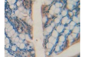 Immunohistochemistry (IHC) image for anti-Agouti Related Protein Homolog (Mouse) (AGRP) (AA 21-131) antibody (ABIN7433411)
