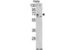 Western Blotting (WB) image for anti-Leiomodin 1 (LMOD1) antibody (ABIN3003829) (Leiomodin 1 抗体)