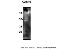 Western Blotting (WB) image for anti-Caspase 6, Apoptosis-Related Cysteine Peptidase (CASP6) (Middle Region) antibody (ABIN2774243)