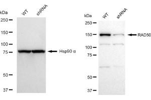 Western blotting analysis using RAD50 antibody (ABIN7800119).