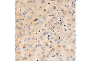 ABIN6278065 at 1/100 staining human liver tissue sections by IHC-P. (ORAI1 抗体  (C-Term))