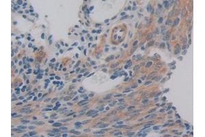Immunohistochemistry (IHC) image for anti-Pyruvate Dehydrogenase Complex, Component X (PDHX) (AA 222-471) antibody (ABIN7443338)