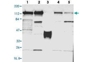 Western blot analysis of Lane 1: RT-4, Lane 2: U-251 MG, Lane 3: Human Plasma, Lane 4: Liver, Lane 5: Tonsil with PPFIBP1 polyclonal antibody  at 1:250-1:500 dilution. (PPFIBP1 抗体)