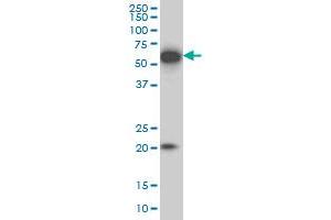 EBF3 monoclonal antibody (M05), clone 8D6 Western Blot analysis of EBF3 expression in IMR-32 .