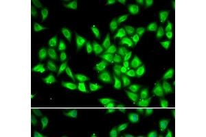 Immunofluorescence analysis of HeLa cells using PCMT1 Polyclonal Antibody (PCMT1 抗体)