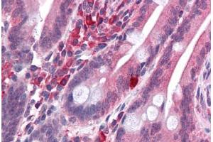 Human Small Intestine: Formalin-Fixed, Paraffin-Embedded (FFPE) (LYRM2 抗体  (C-Term))