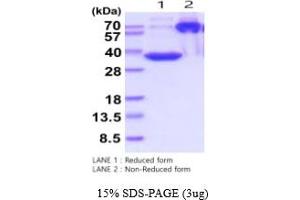 SDS-PAGE (SDS) image for Microfibrillar-Associated Protein 4 (MFAP4) (AA 22-255) protein (His tag) (ABIN5854748)